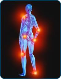 Arthritis